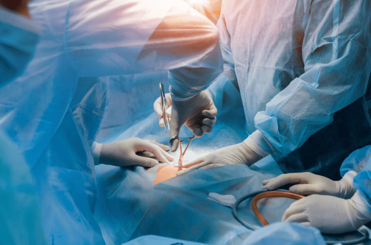 Laparoscopic